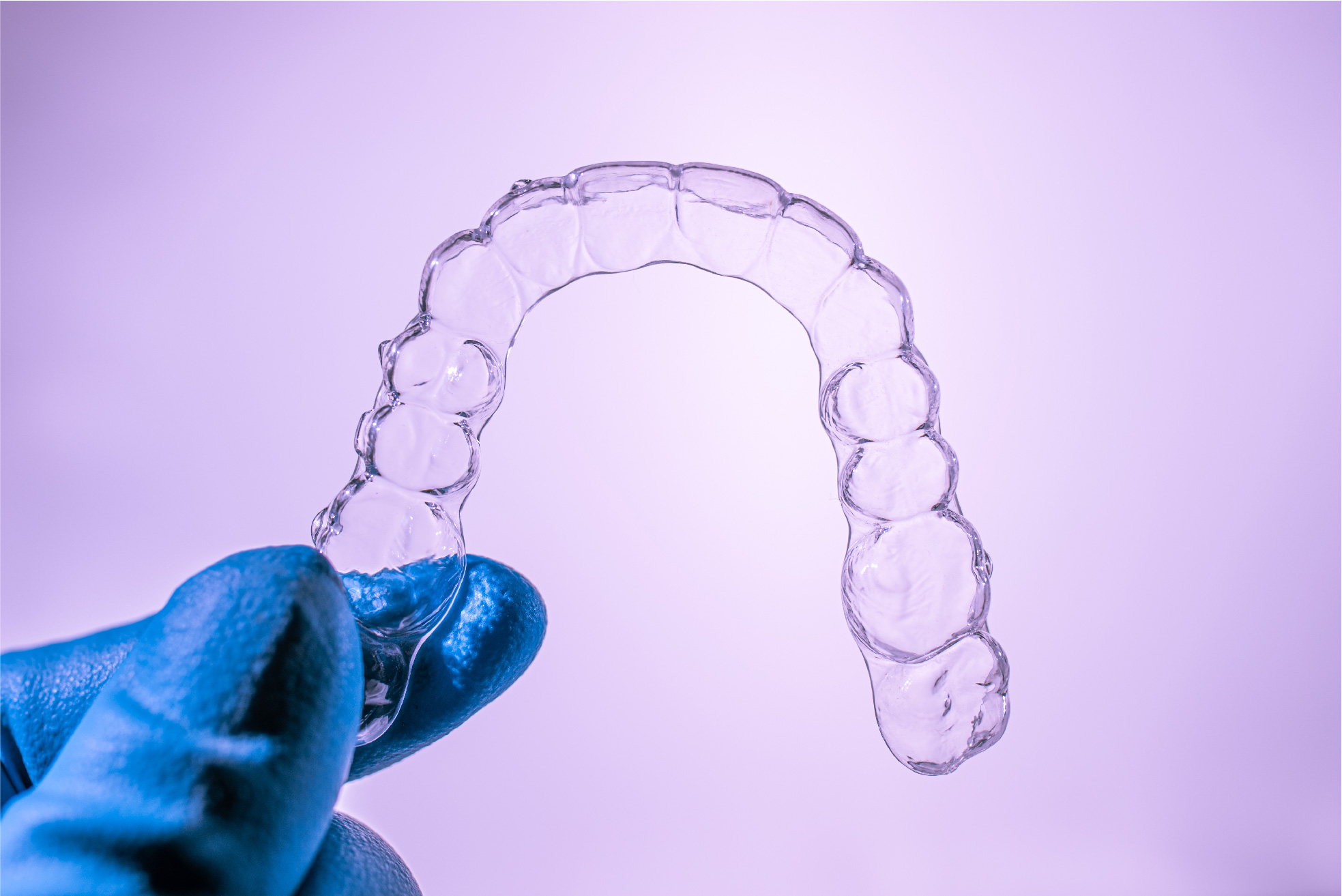 aligners how 2